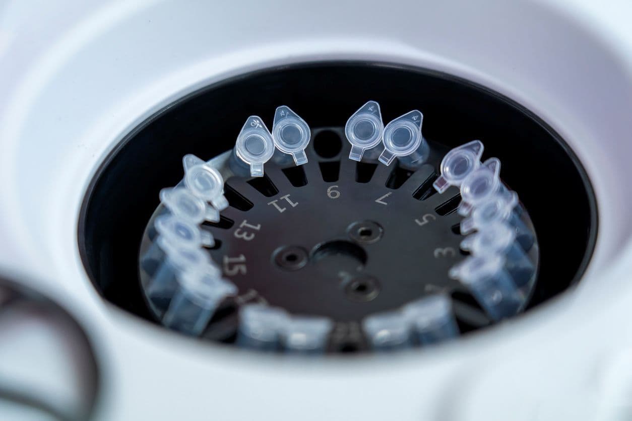 Close-up view of a laboratory centrifuge with sample tubes arranged in the rotor used for separating biological samples
